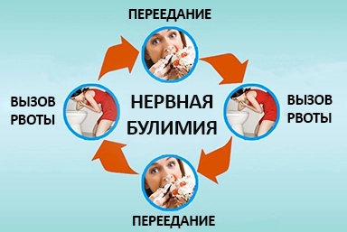 Лечение булимии в Волжске